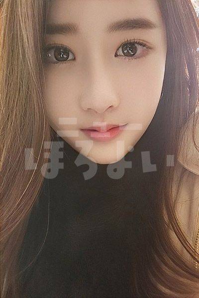 Photo2